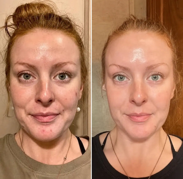 Hydration & Elasticity
